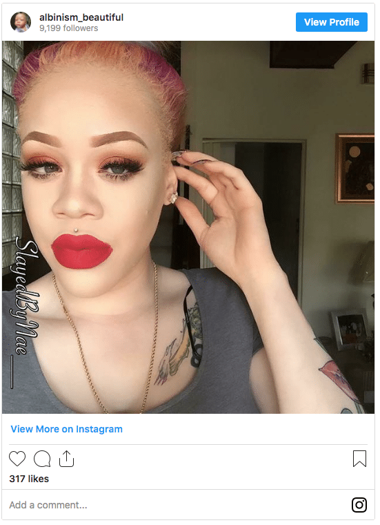 albimism hair color streaks instagram post