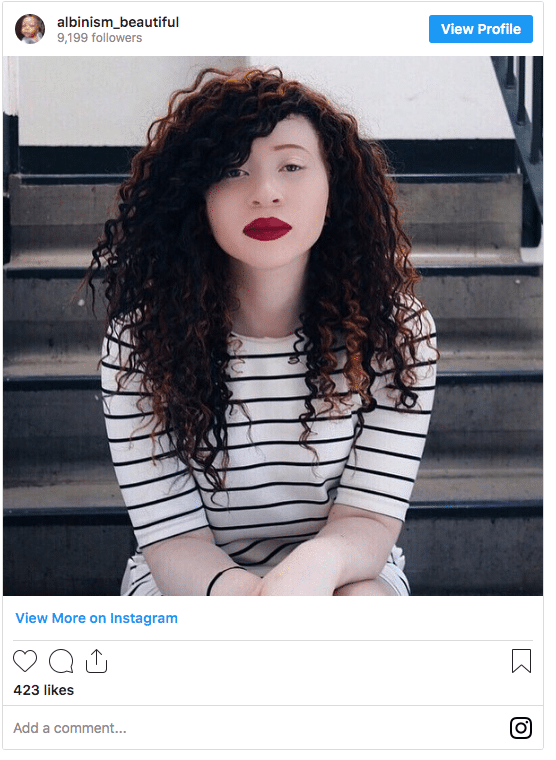can albino people dye their hair dark hair instagram post